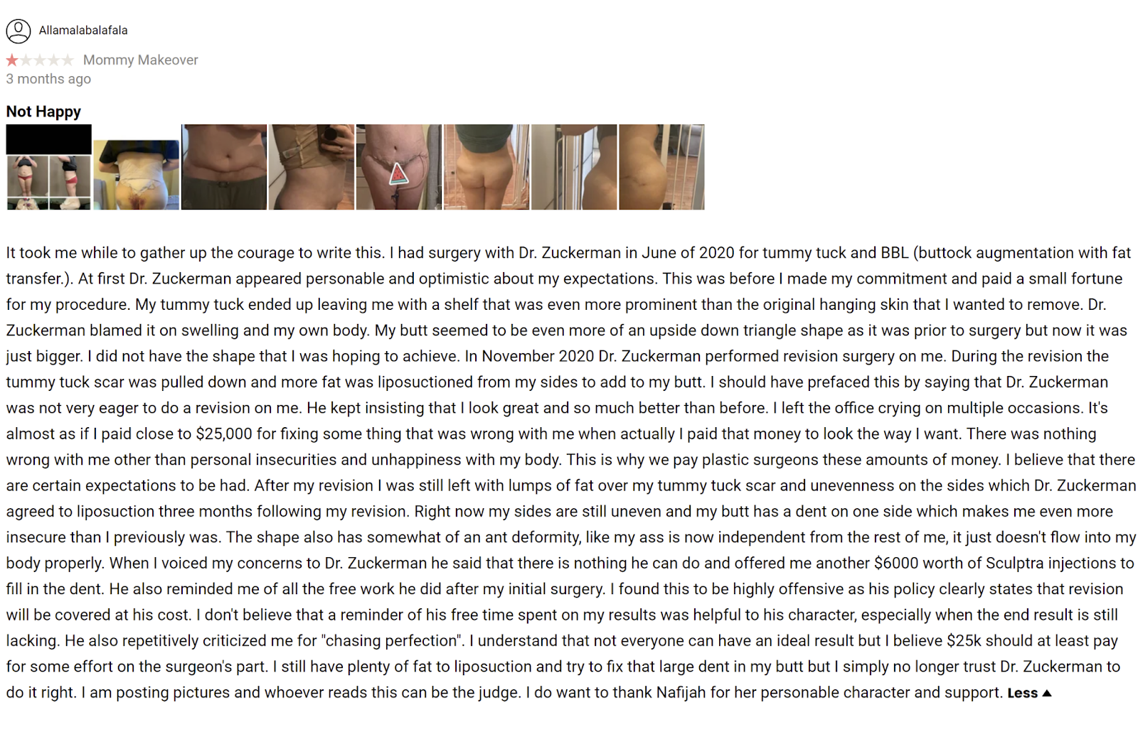Zuckerman Plastic Surgery review