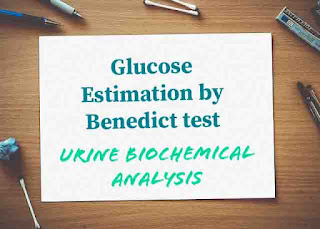 Glucose estimation in urine