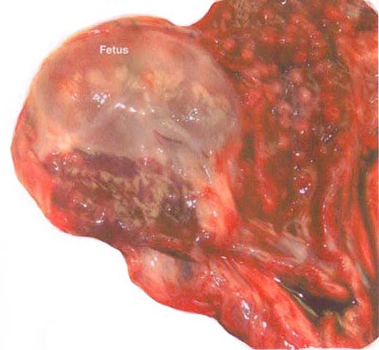 Embryonic sac in opened uterine horn. Note the four rows of pale caruncles in the other horn