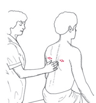 Pinched Nerve in Neck Exercise - Scapular retractions 