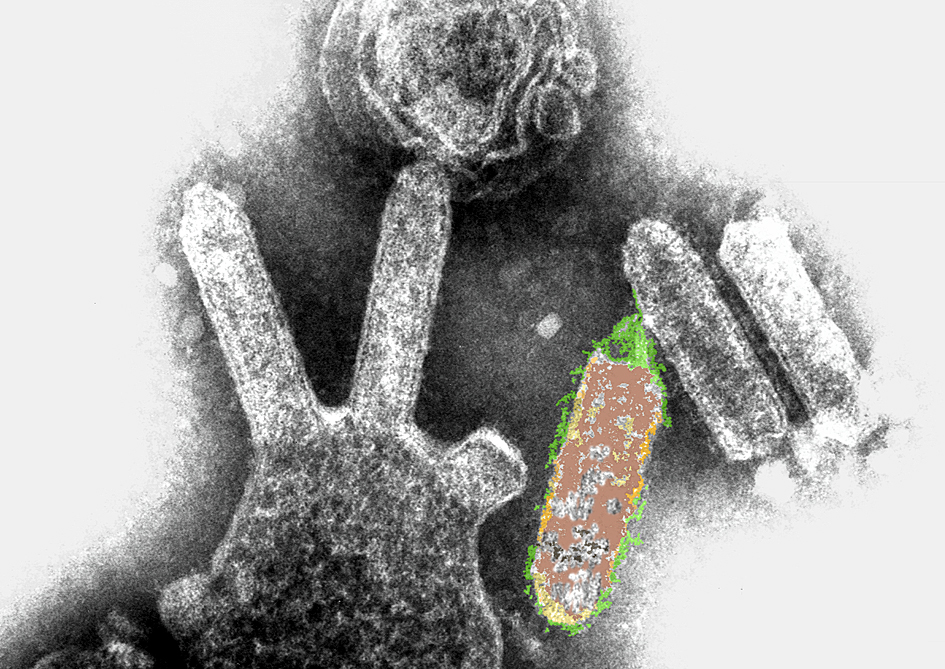 Micrografia eletrônica do Lyssavirus - Wikipédia 