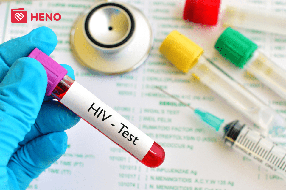 xét nghiệm HIV khi thực hiện tầm soát bệnh lây qua đường tình dục