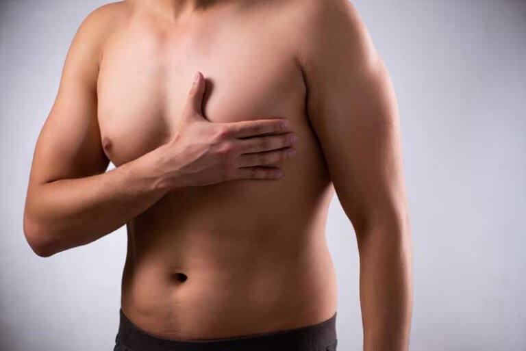 Ginecomastia o reducción de mamas para hombres en GDL