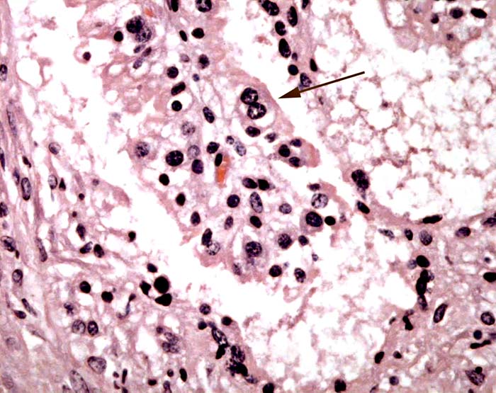 Binucleate cell at arrow.
