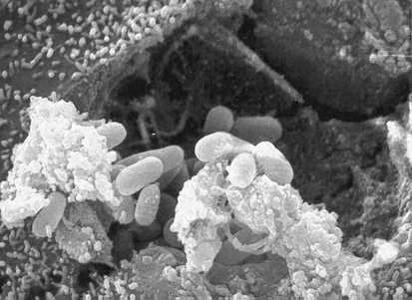 Figure A: Scanning electron micrograph showing an eukaryotic cell bursting and releasing spores of <em>Encephalitozoon hellem</em> to the extracellular medium.