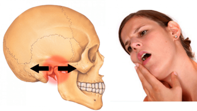 Đau răng sâu khiến người bệnh đau cả đầu