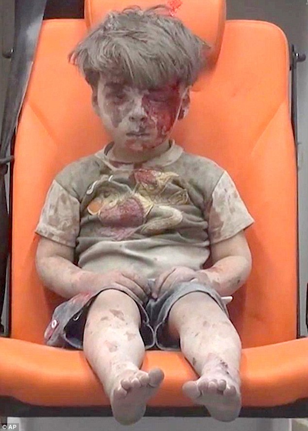 syrian boy in shock.jpg