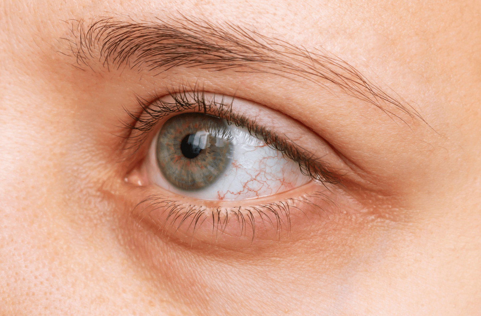 A close up image of a woman's dry eye