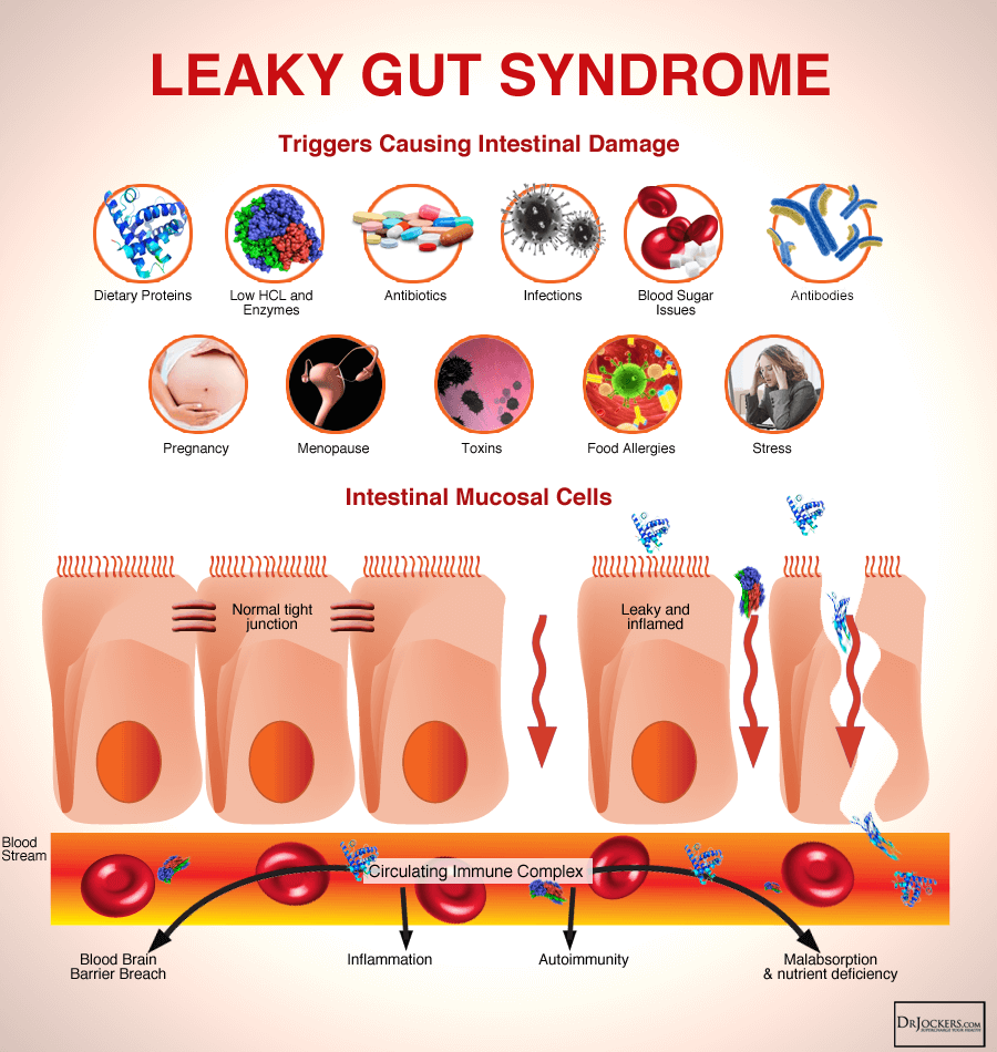 Healing Leaky Gut, Healing Leaky Gut with Fasting and Liquid Nutrition