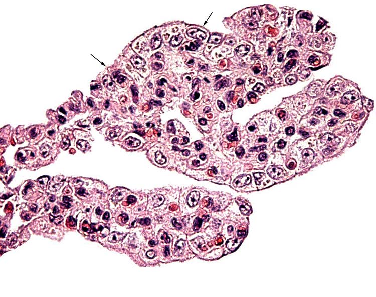 Terminal villi of anoa placenta with trophoblastic binucleate cells at arrows