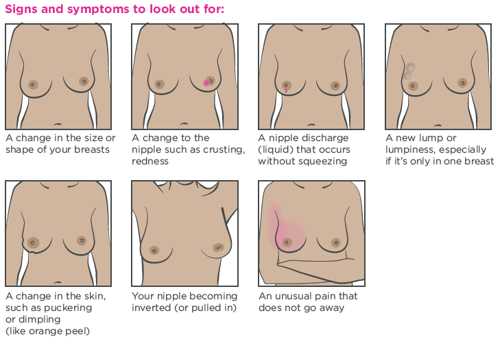 Признаки и симптомы груди.png