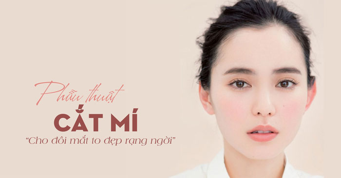 Cắt mắt 2 mí Hàn Quoosxc - Cho đôi mắt đẹp rạng ngời