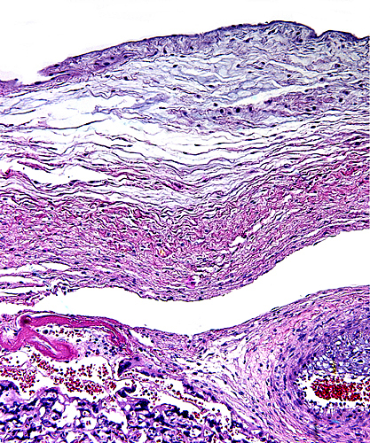 Fetal surface of mature pacarana placenta with amnion on top.
