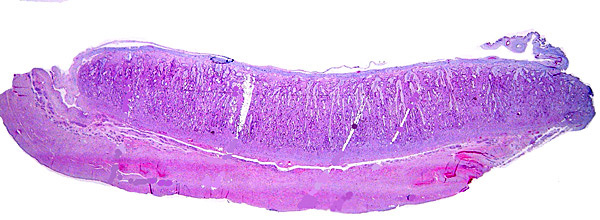 Implanted term placental cotyledon; uterus below.