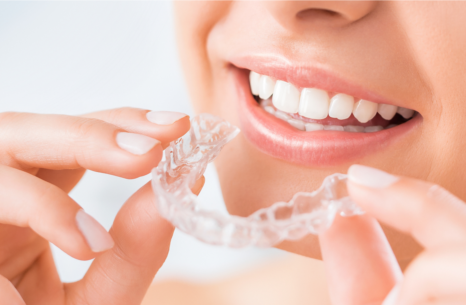 woman smiling holding Invisalign aligner about to put them in her mouth