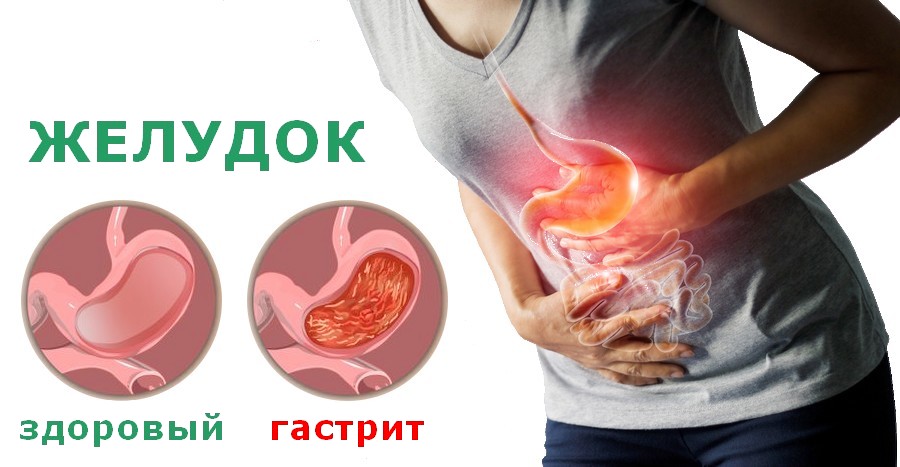 Что можно при гастрите?