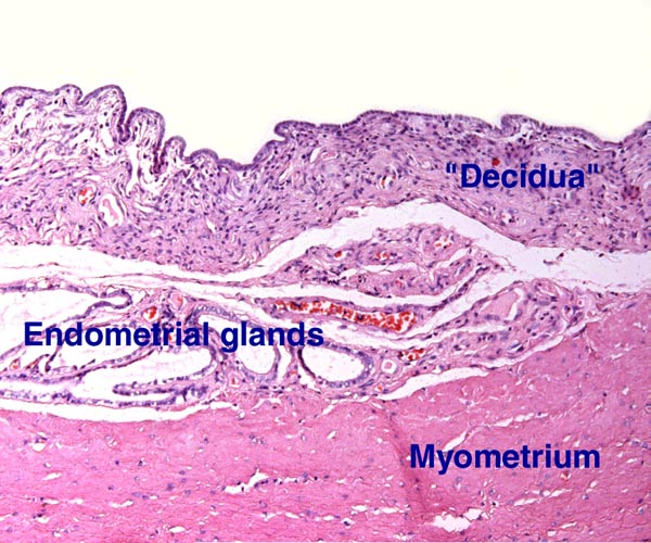 Endometrium adjacent to placental implantation