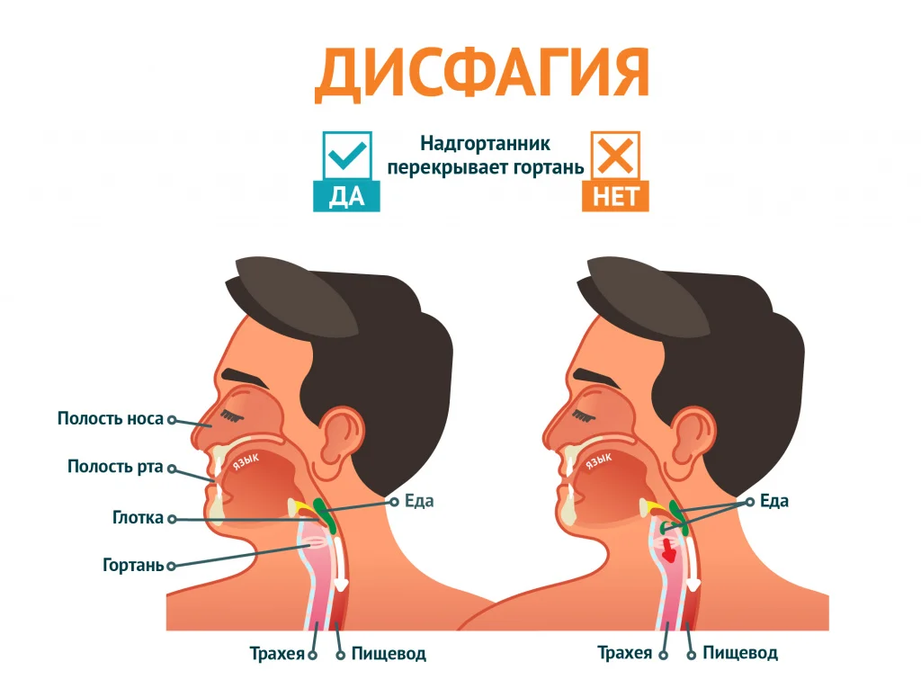 Часто сглатываю слюну