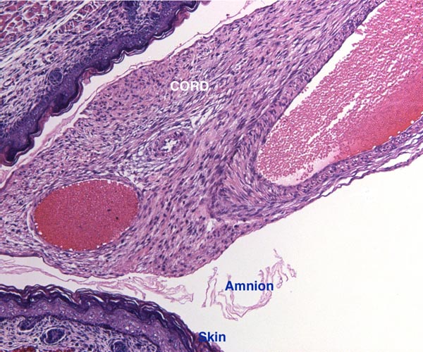 The picture at left is a section through the main umbilical cord