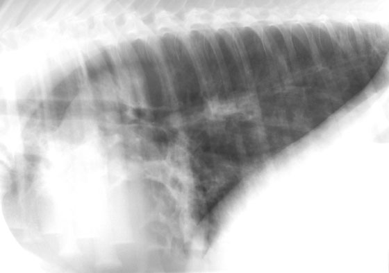 A left lateral radiograph of the thorax of a young horse with acute viral pneumonia. Some lung lobules are consolidated and adjacent lobules are hyperaerated. Changes are more severe around the hilus and in dependent (ventral) lung segments. This pattern could be confused with chronic cavitary lung disease.