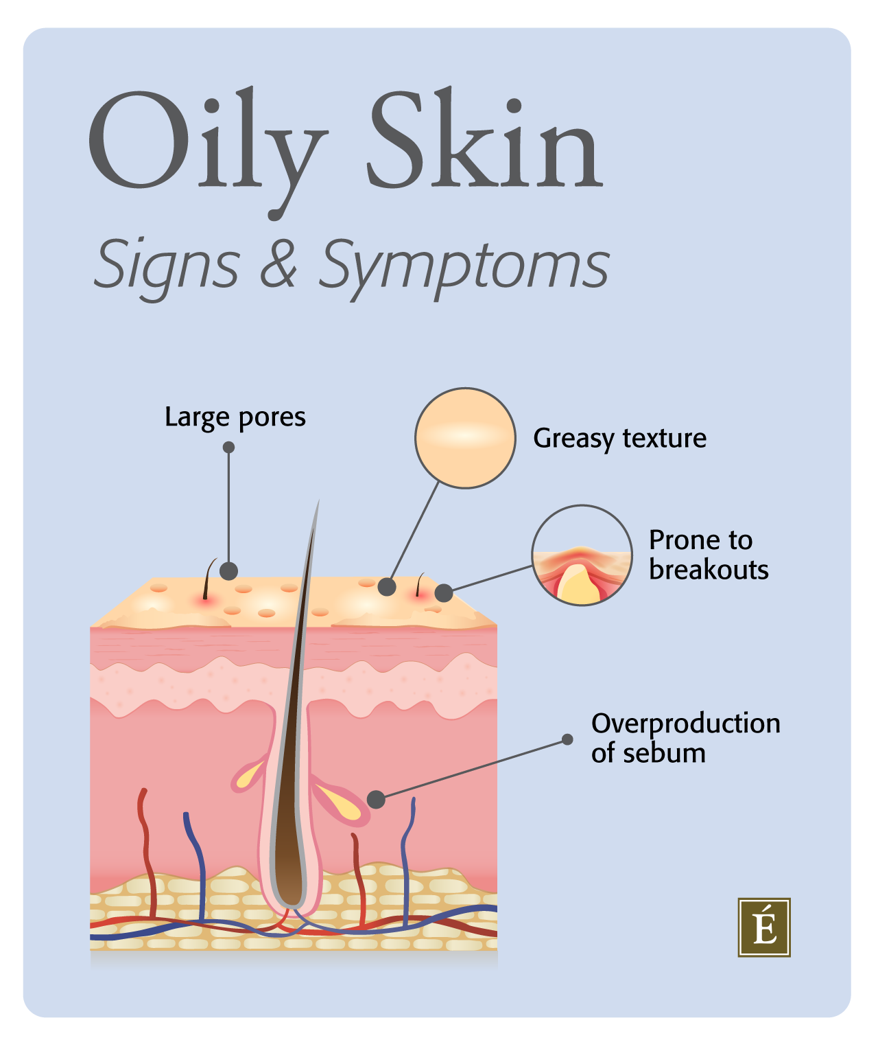 oily skin 