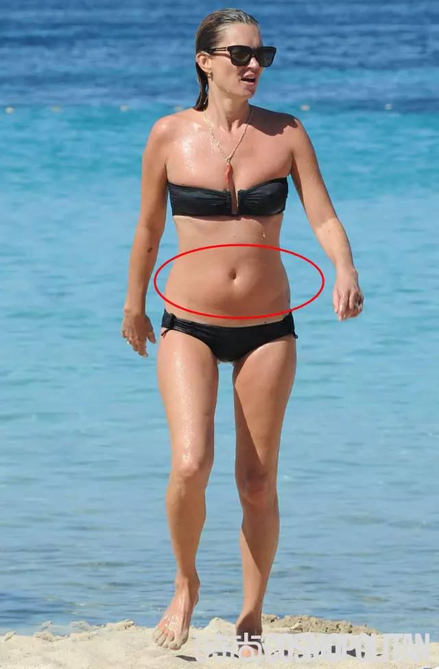 Learn Kate Moss 3 Strokes With Weight Loss Makes You Forget About It