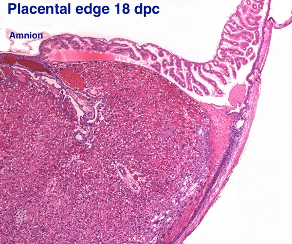 These two photographs show the edge of the 18 dpc placenta