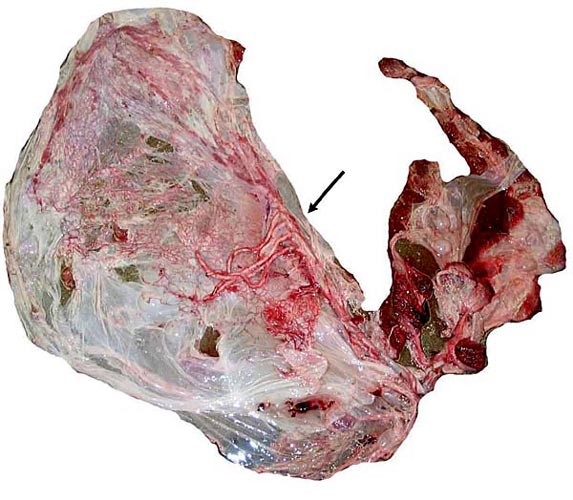 Fetal surface of autolyzed buffalo placenta