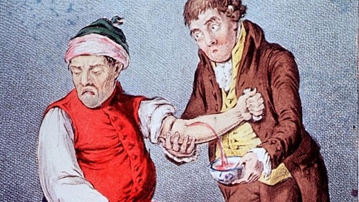 https://www.history.com/news/a-brief-history-of-bloodletting