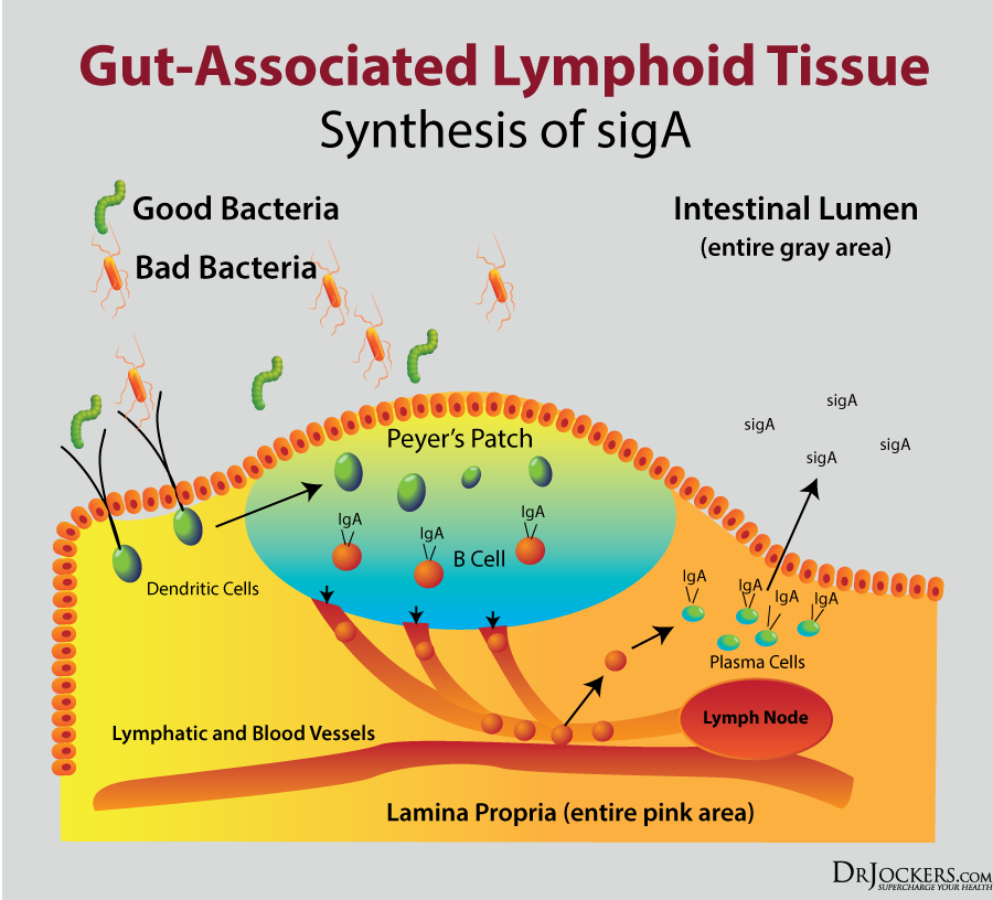 gut mucosa, Gut Mucosa:  How To Strengthen Your sIgA Gut Immune System