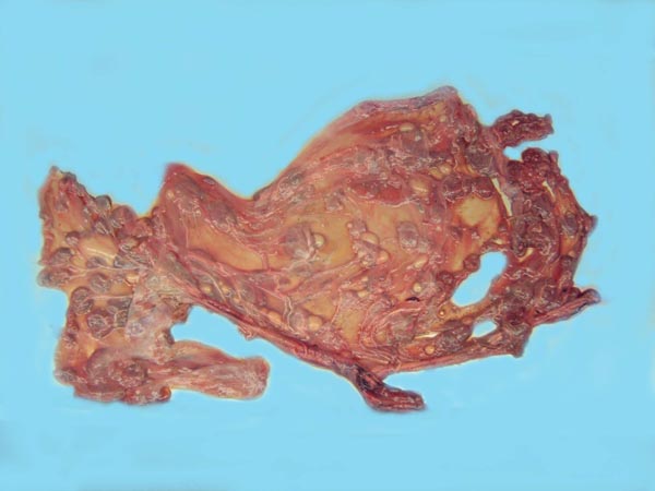 Macroscopic appearance of term takin placenta