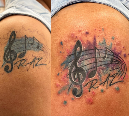 Before And After Musical Symbol 