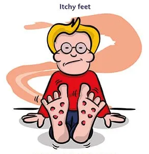 Itchy feet: ngứa ngáy chân tay, muốn được đi du lịch đâu đó/làm điều gì đó khác - từ vựng về cơ thể người trong tiếng anh