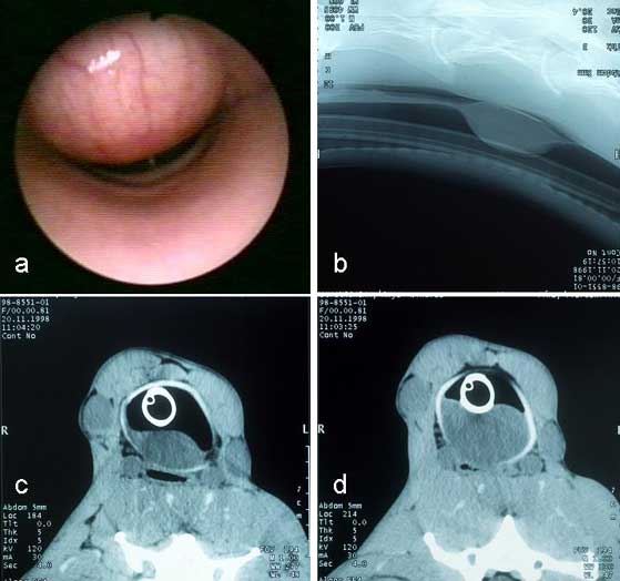 Tracheal narrowing caused by means of a dorsal rhabdomyoma (a), lateral radiographic (b) and computed tomographic images of an intratracheal rhabdomyoma (c,d)