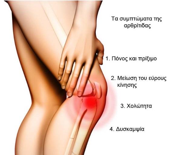 http://www.kostaszahos.com/images/site_photos/knee_pathology/knee.pathology.2.osteoarthritis.symptoms.jpg
