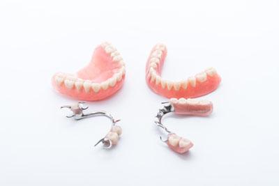 How Does a Denture Stay in Place? - Advanced Dental New Windsor New York