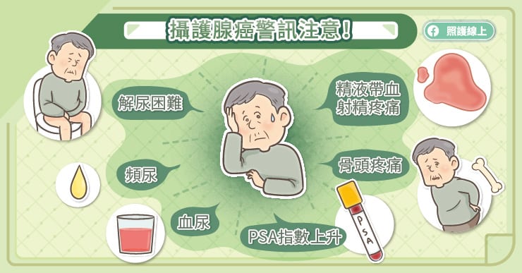 攝護腺癌警訊注意