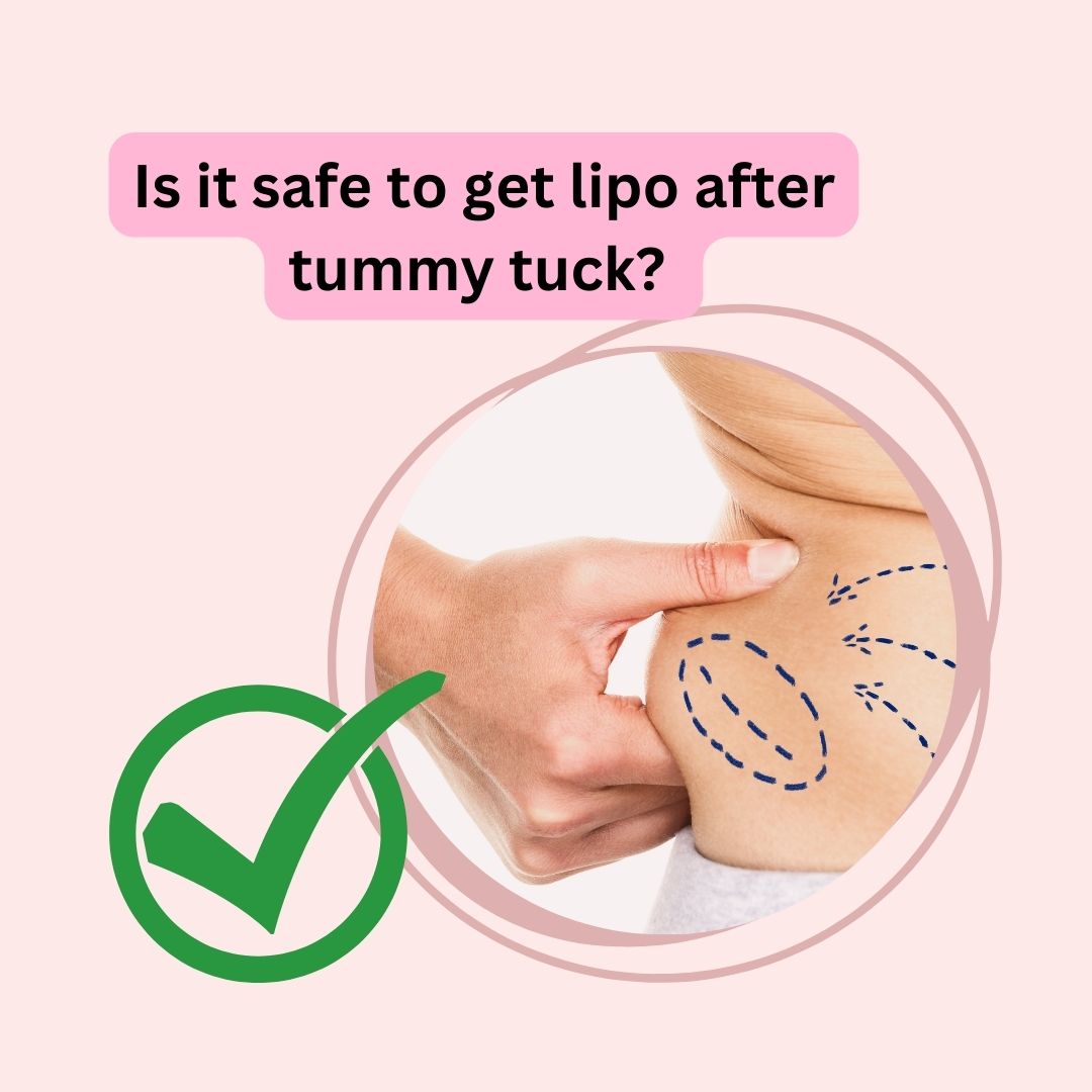 Is it safe to get lipo after tummy tuck?