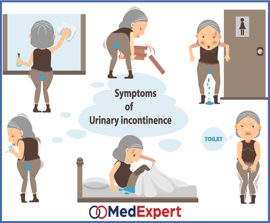 urinary incontinence symptoms