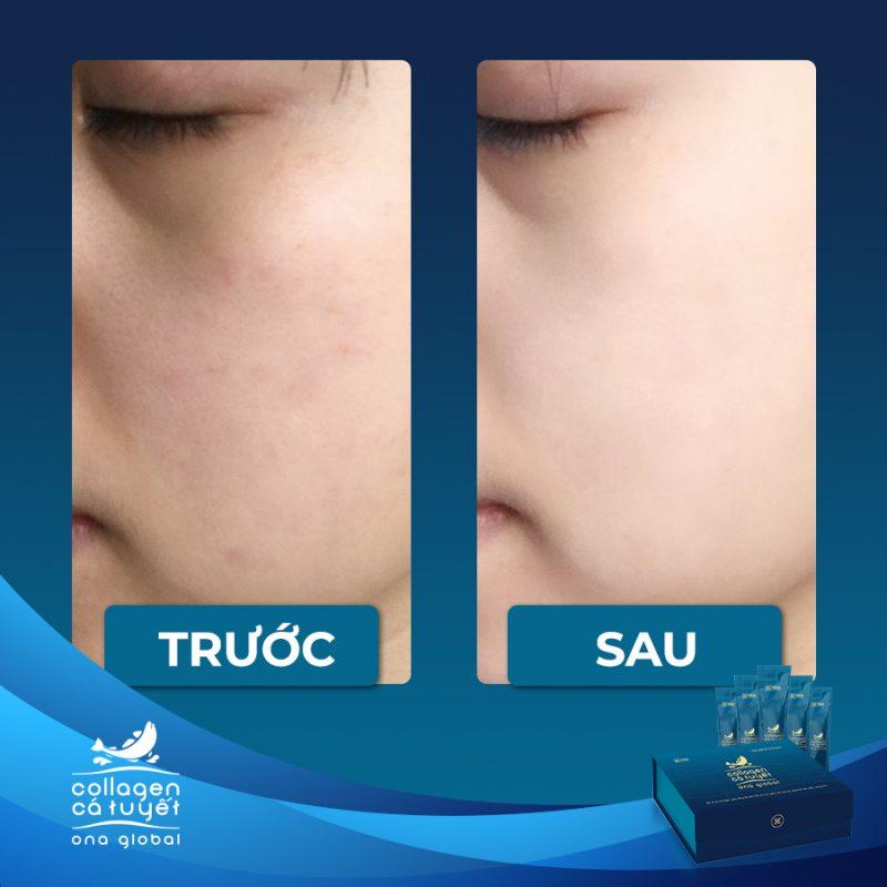 https://collagencatuyet.vn/wp-content/uploads/2020/12/collagen-ca-tuyet-345-800x800.jpg