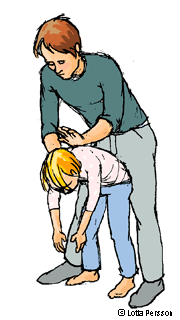 Illustration som visar hur man gör ryggslag om ett barn har satt i halsen