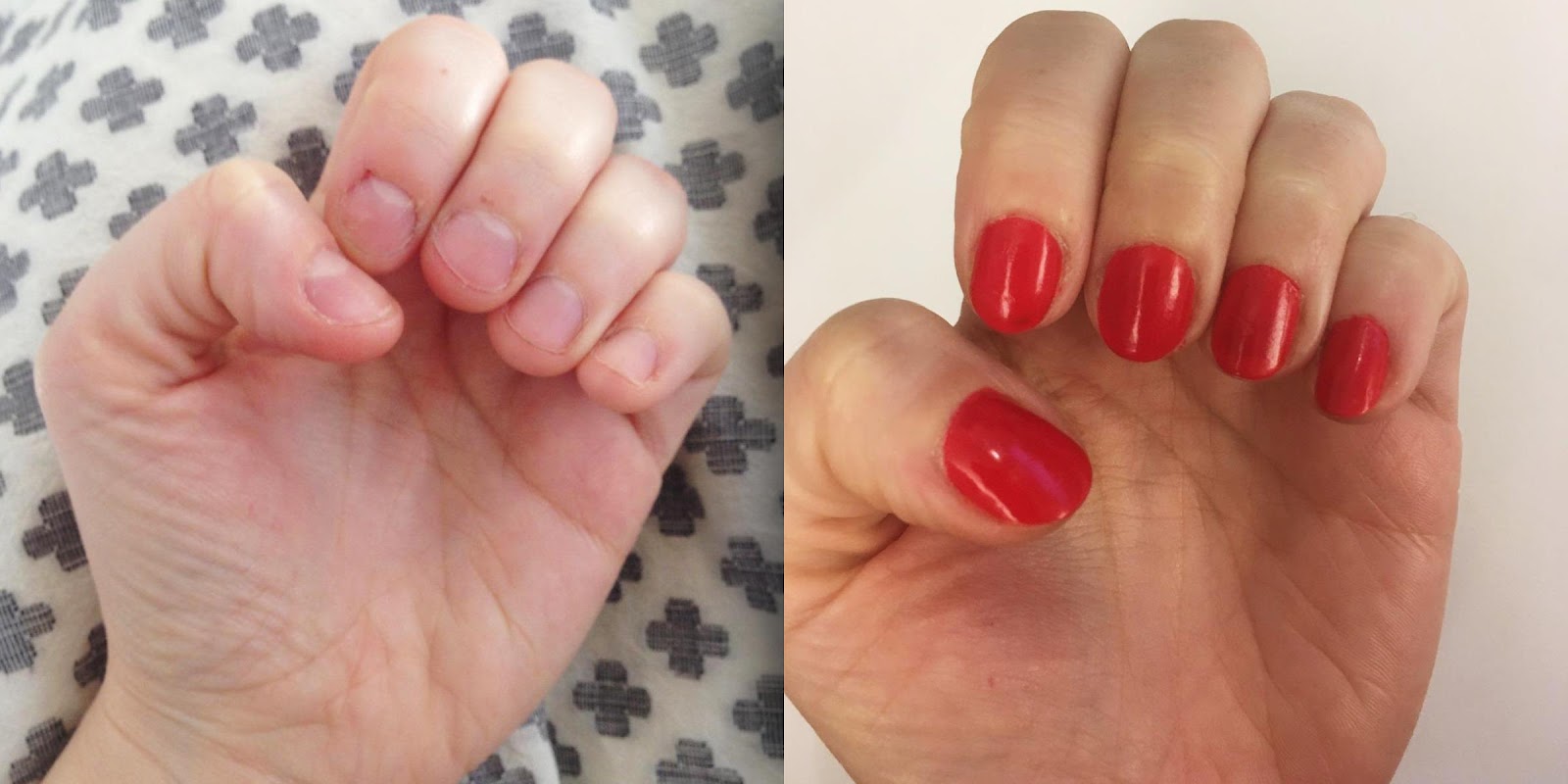 anti-nail-biting-polish-today-main-spplit-191002-new_dc654dc9f1bb527ea978872a5505e5b4