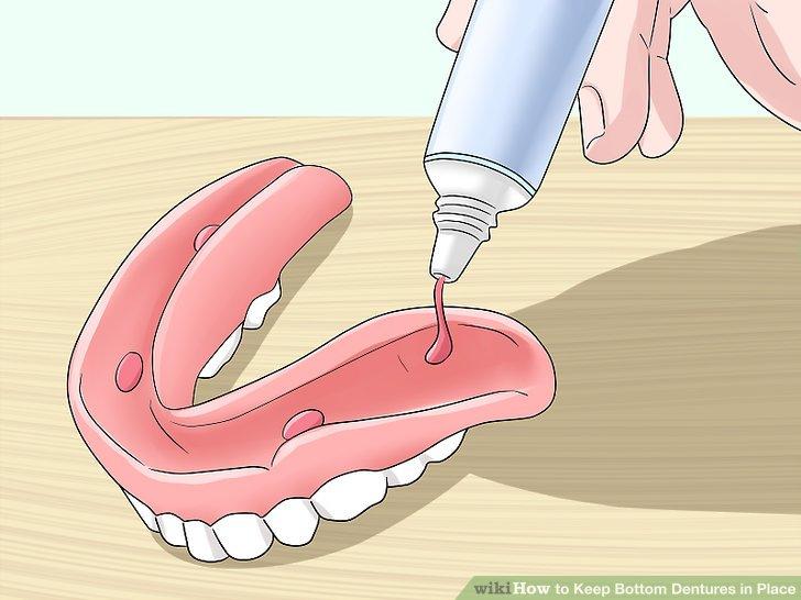 Image result for What should I do if my dentures are loose?