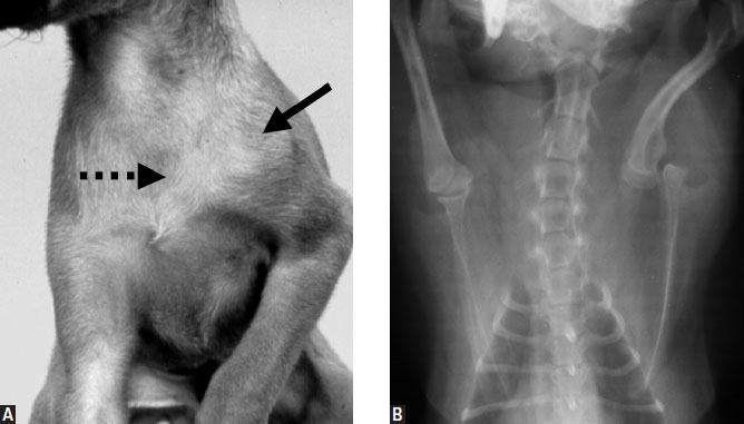 Congenital shoulder luxation in a puppy