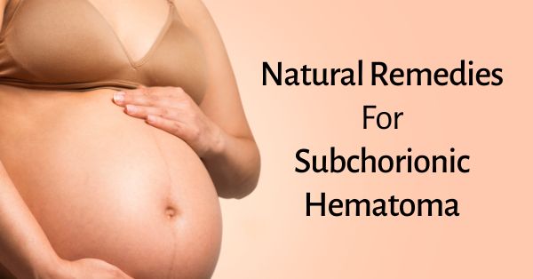 natural remedies for subchorionic hematoma
