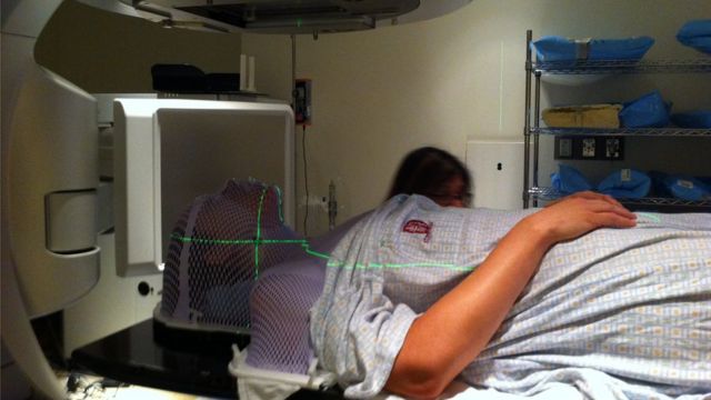Sarah McDonald recibiendo tratamiento de radiación