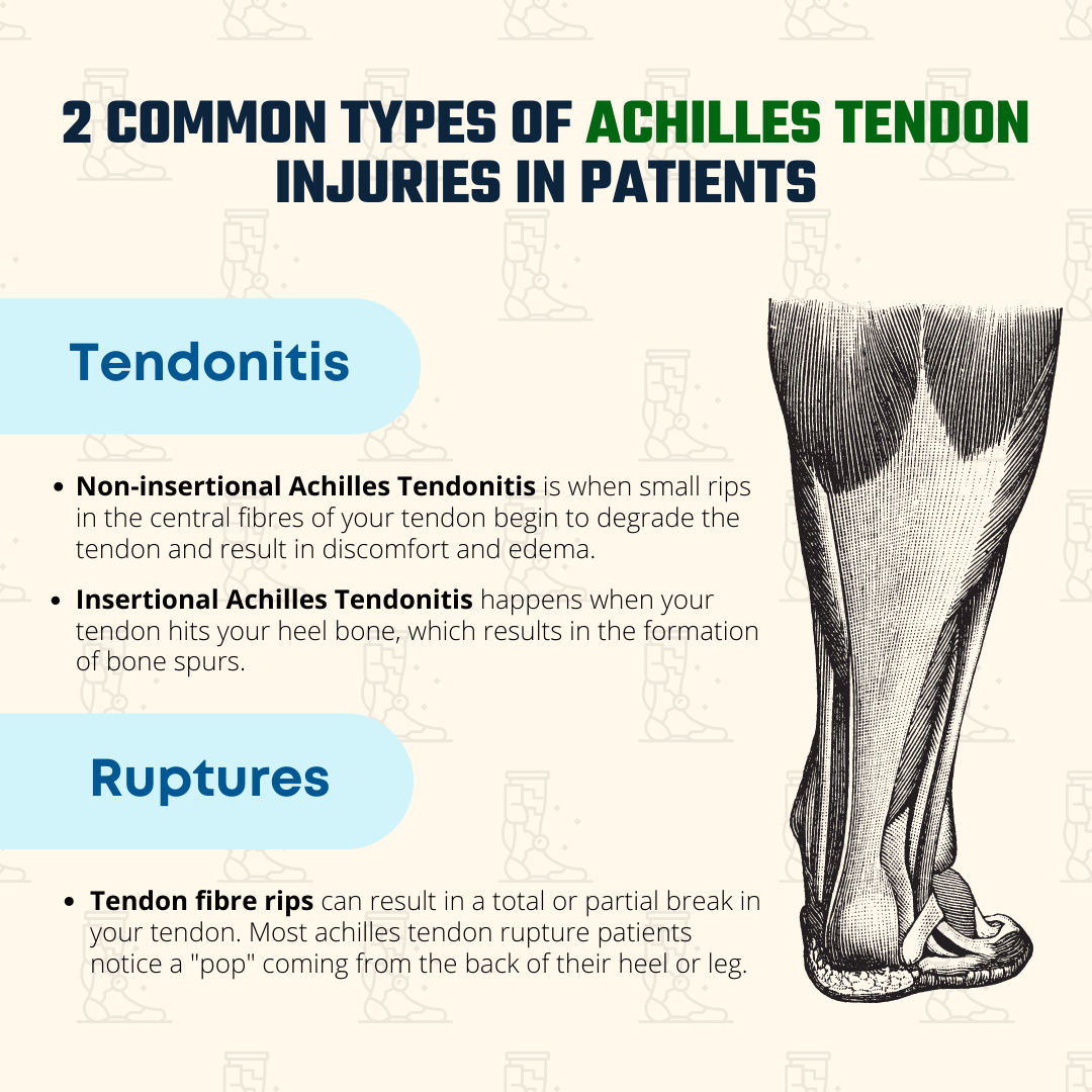 2 Common Types of Achilles Tendon Injuries in Patients - MY Fitness Clubb