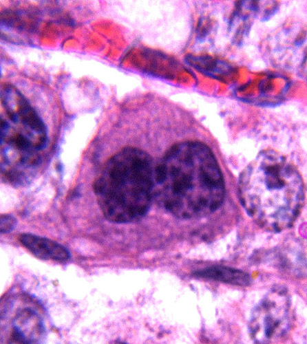 Typical binucleate trophoblast