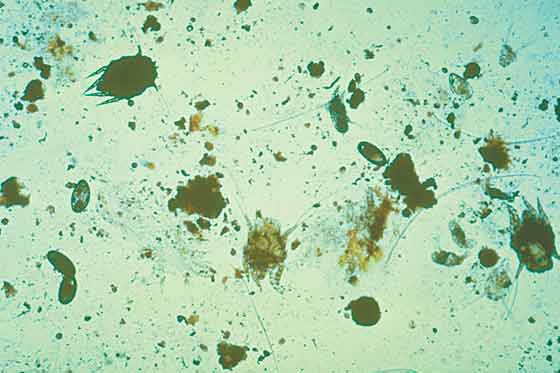 Otodectes cynotis mites and eggs (original magnification x40)