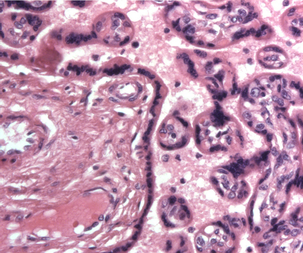 Mature placental villous tissue of Kolb's monkey. Stem villus on the left